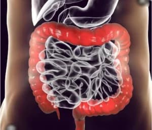 Proctolectomia por Videolaparoscopia